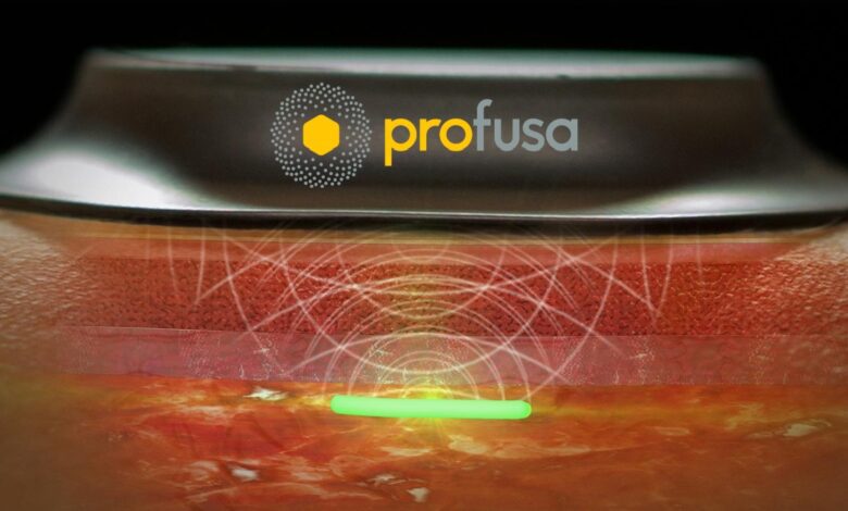 Profusa Lumee Oxygen digital health device interacting with sensor under person's skin.