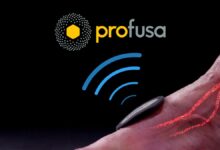A close-up image of a wearable biosensor device on a person's hand with red-highlighted blood vessels, showing wireless signal waves and the Profusa logo above, representing biomedical monitoring technology.