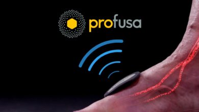 A close-up image of a wearable biosensor device on a person's hand with red-highlighted blood vessels, showing wireless signal waves and the Profusa logo above, representing biomedical monitoring technology.