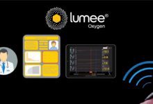 Graphic showing the Lumee Oxygen system with a doctor icon, patient report, tablet displaying oxygen data, and a wearable sensor sending wireless signals.