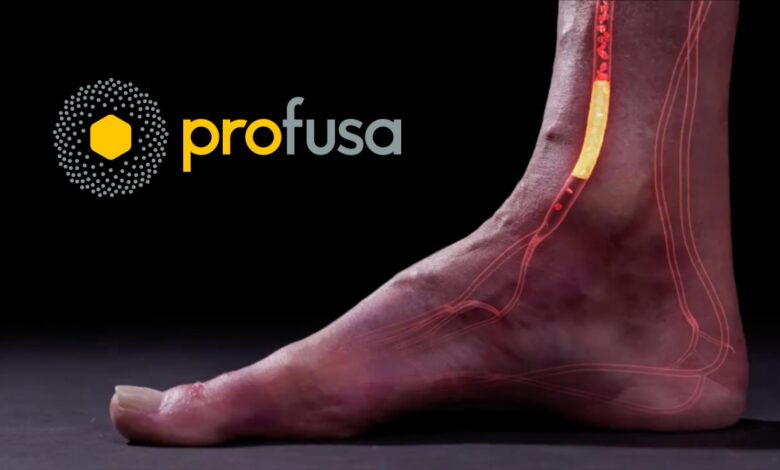 Medical illustration of a foot with glowing internal sensor and blood vessels highlighted, next to the Profusa company logo on a black background.